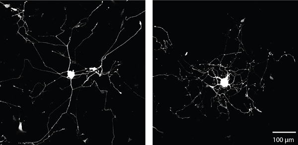 Branching growth (right) results from adding the axonally targeted mRNA for the protein beta-actin.